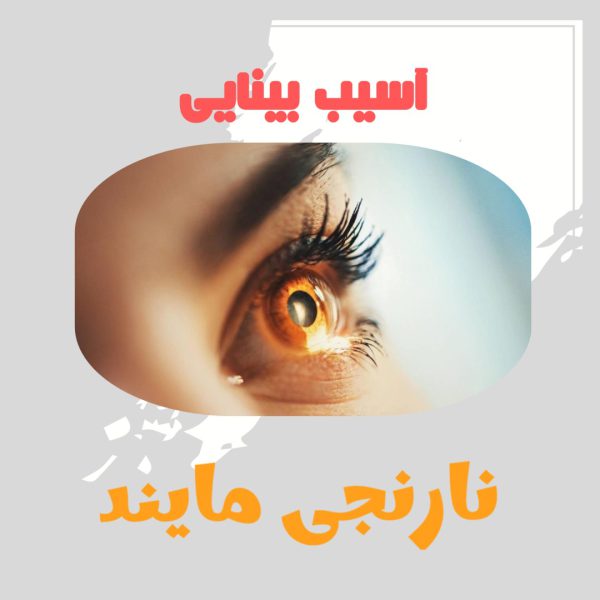 آسیب بینایی | کاملترین پاورپوینت آسیب و اختلال بینایی در 24 اسلاید